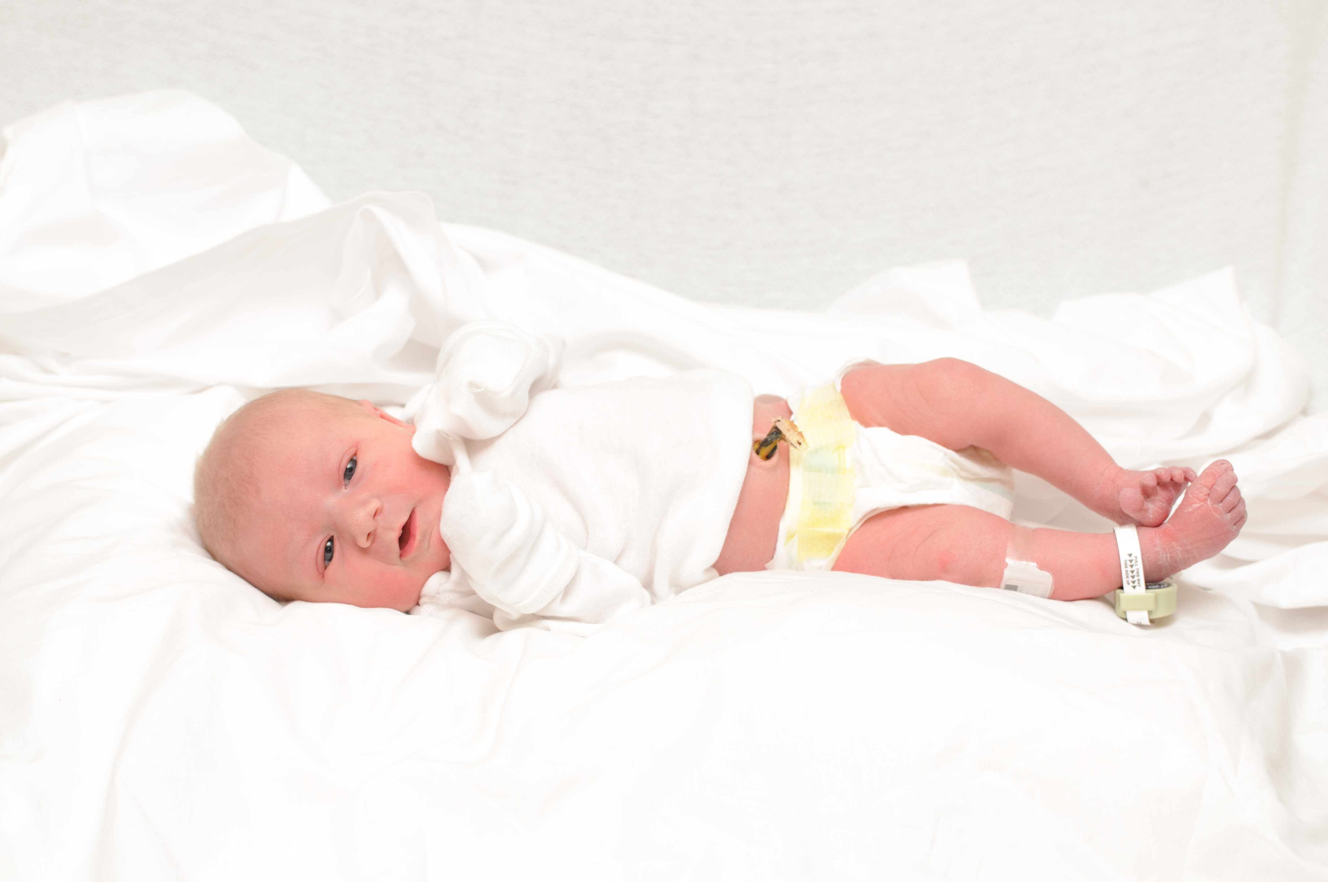 Newborn with umbilicord stump